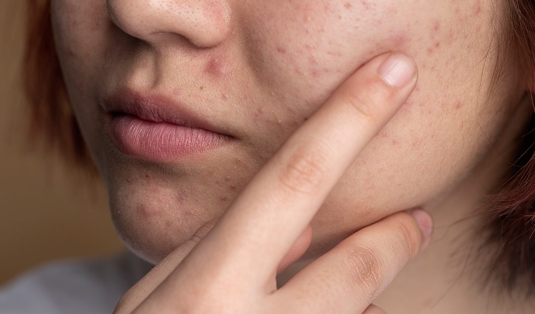 Common Skin Problems & How to Treat Them – A Guide by Nazirin Skin Clinic