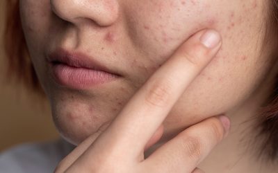 Common Skin Problems & How to Treat Them – A Guide by Nazirin Skin Clinic